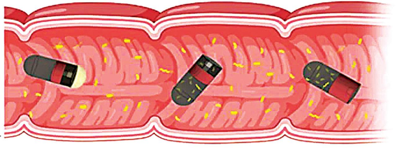 IIT-D and AIIMS develop swallowable microdevice for microbiome study